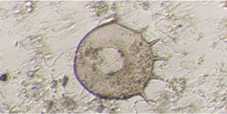 産業廃棄物をコーディネイトする京葉興業の活性汚泥で観察される微生物　肉質虫類の写真