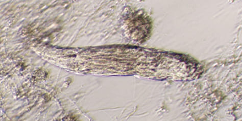 産業廃棄物をコーディネイトする京葉興業の活性汚泥でで観察される微生物　繊毛虫類がフロックの形成を促進させる様子